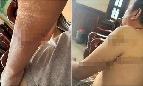 Bắt giữ 3 nghi phạm truy sát người đàn ông ở Đồng Nai