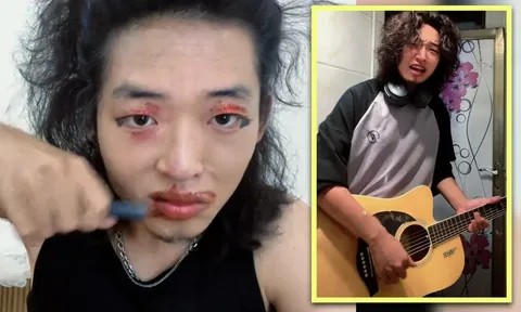 Cánh tay run rẩy từng khiến chàng trai này tự ti, giờ trở thành “vũ khí” lan tỏa tinh thần lạc quan đến với hàng trăm nghìn người hâm mộ