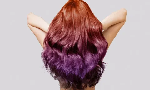 Nhuộm tóc mỗi tháng để giống idol, cô gái 20 tuổi trả giá đắt khi mắc căn bệnh này