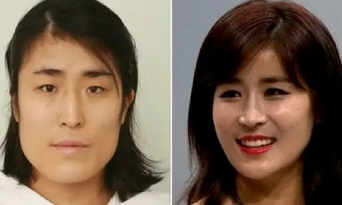 30 năm không dám soi gương, cô gái trẻ bỗng "lột xác" nhờ thẩm mỹ, kết hôn với chính bác sĩ phẫu thuật cho mình