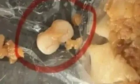 Phát hiện “răng người” trong bánh bao, người đàn ông hoảng sợ đến nôn mửa, lập tức báo cảnh sát