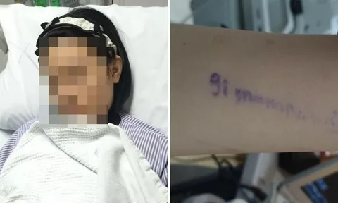 Bị nhóm bạn bắt nạt, hành hung trong nhà vệ sinh, bé gái 13 tuổi phải nhập viện khẩn cấp