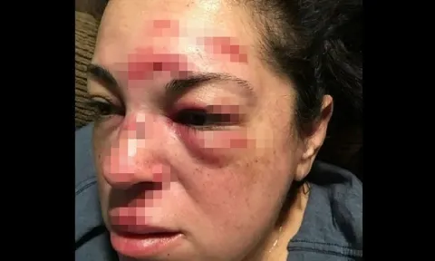 Vấp ngã, người phụ nữ nhận bồi thường hơn 300 tỷ đồng