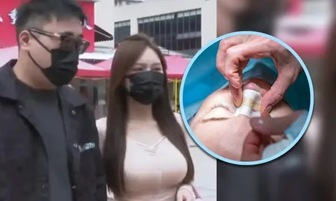 Cô gái tiêu hết gần 4 tỷ đồng bạn trai gửi giữ hộ để phẫu thuật thẩm mỹ