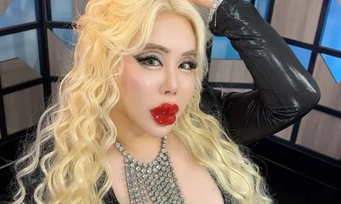 Bị bắt nạt từ nhỏ, chàng trai chi hơn 17 tỷ đồng để biến thành "người đẹp nhất thế giới”