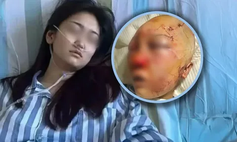 Vừa hồi phục sau vụ hành hung lại nhận tin mắc bệnh bạch cầu, cô gái trẻ kêu cứu trong tuyệt vọng: “Tôi không muốn chết"