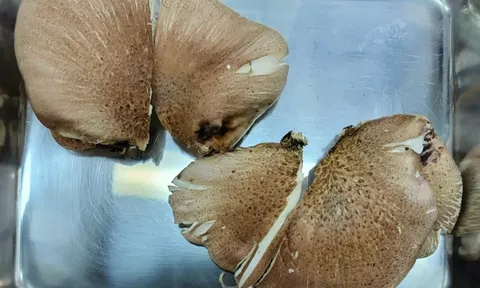 Tin AI, cụ ông 70 tuổi suýt mất mạng