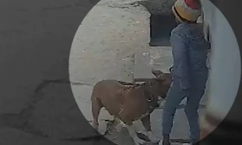 Bé trai mất tai vì bị chó Pitbull tấn công