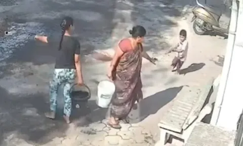 Clip: Bé trai 4 tuổi bị bà nội đổ nước sôi lên người, bỏng nặng 45%