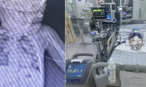 Bé gái hơn 1 tuổi bị ngưng tim, ngưng thở chỉ vì phút lơ là của người lớn: Bác sĩ cảnh báo nguy cơ tiềm ẩn từ những vật dụng quen thuộc này trong nhà