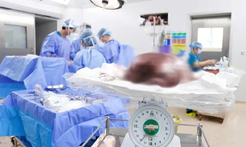 Phát hiện "vật thể lạ" nặng gần 12kg, to như bụng mang song thai trong người cô gái trẻ