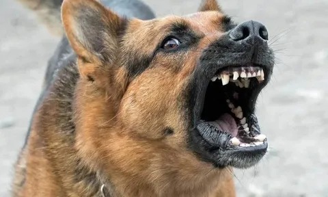 Chỉ sau một tháng từ khi bị chó cắn vào mặt, bé trai 11 tuổi bất ngờ trở nặng rồi qua đời khiến nhiều người xót xa