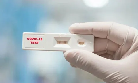 Hà Nội ghi nhận thêm 17 ca Covid-19 mới, người dân cần thực hiện 2 biện pháp phòng bệnh, lưu ý về biến thể "ve sầu"