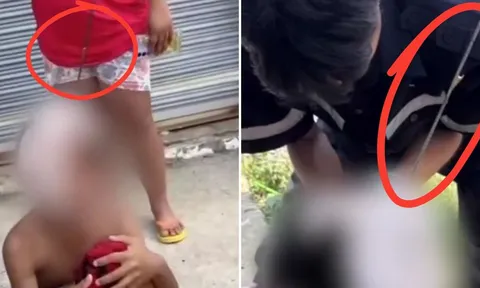 Thái Lan: Súng bắn cá phát nổ ngoài ý muốn, thiếu niên 13 tuổi phải nhập viện cấp cứu