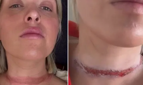 Thời trang suýt thành thảm kịch, nữ fashionista suýt bị “chém đầu” vì một phụ kiện quen thuộc