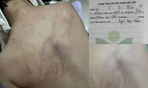 Tình tiết mới nhất vụ bé gái 4 tuổi bị giáo viên đánh đập, ném vào tường ở Hà Nội