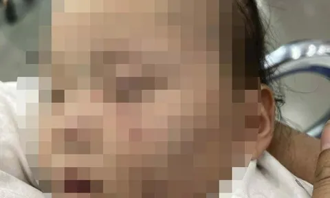 Vụ bé gái 1 tuổi bị bầm tím mặt khi gửi ở cơ sở mầm non tại Bắc Ninh: Danh tính bảo mẫu, sức khỏe cháu bé hiện ra sao?