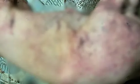 Vụ kỹ sư thú y cấu kết với vợ chồng buôn lợn dịch bệnh tuồn “thịt thối” vào chợ dân sinh và bếp ăn công nhân: Lời khai tiết lộ thủ đoạn kinh hoàng