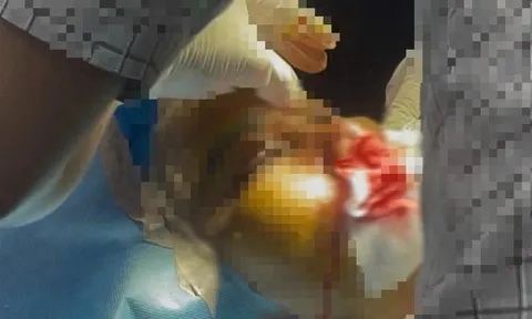 Hé lộ danh tính người phụ nữ tử vong sau khi được "truyền trắng da" tại nhà, ai là người truyền?