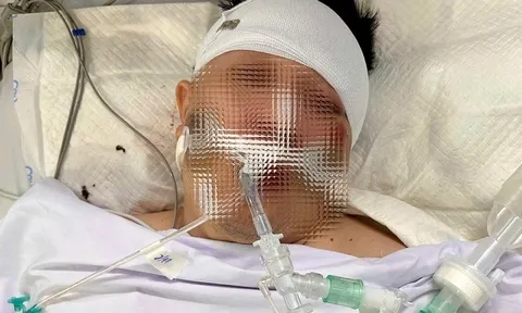 Nam thanh niên nguy kịch sau khi tông trúng chó chạy rông sang đường