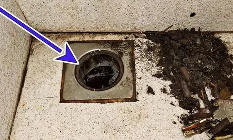 Bé trai 8 tuổi nôn ra sinh vật sống suốt 1 tháng: Thủ phạm ghê rợn đến từ nhà tắm