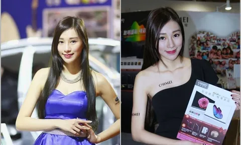 Nữ người mẫu tử vong sau khi tiêm propofol chữa mất ngủ