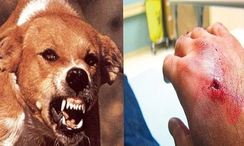 Tiêm vaccine dại gây có ảnh hưởng trí nhớ?