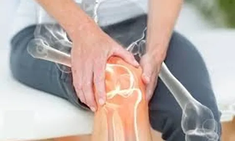 Loãng xương: “Sát thủ thầm lặng” làm suy sụp sức khỏe, gia tăng tỷ lệ tử vong