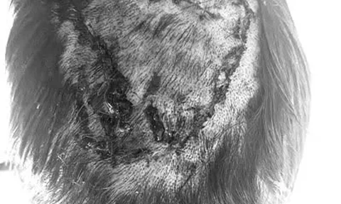 Chống bão Wipha, cụ ông 71 tuổi bị chấn thương nặng khi trèo cắt cành cây