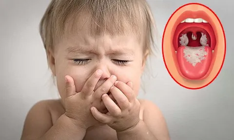 Bổ sung thêm 1 liều vaccine phòng bệnh bạch hầu cho trẻ 7 tuổi