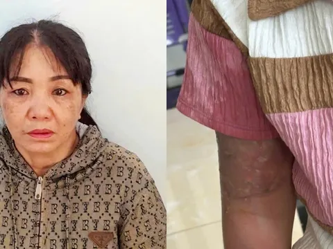 Kiên Giang: Bắt khẩn cấp mẹ nuôi tạt nước sôi vào người bé 12 tuổi