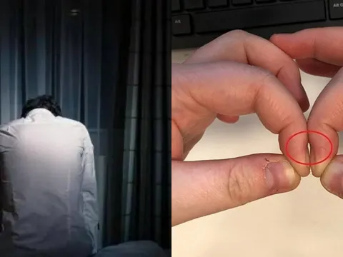 Tại sao ung thư phổi khi phát hiện thường đã ở giai đoạn cuối?