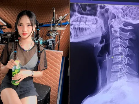 Uẩn khúc vụ nữ ca sĩ qua đời khi đi Massage