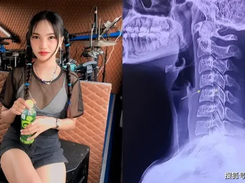 Nguyên nhân bất ngờ vụ nữ ca sĩ qua đời nghi sau khi đi massage