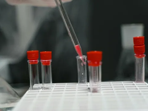 Nóng: Australia làm thất lạc 300 lọ virus, tất cả đều cực kỳ nguy hiểm với con người