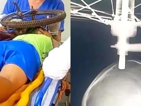 Bé trai 9 tuổi bị bu-lông xe đạp cắm xuyên sọ sống sót kỳ diệu