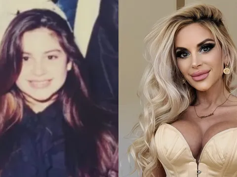 Bà chủ doanh nghiệp vung tiền truyền máu từ con trai để "cải lão hoàn đồng"