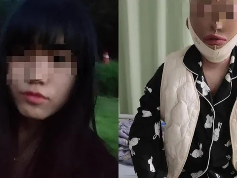 12 năm tù cho thanh niên tạt xăng hủy hoại cuộc đời bạn gái vì đòi chia tay