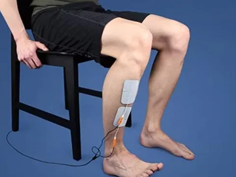 Ngồi vắt chéo chân 5–6 tiếng/ngày, nam sinh lớp 10 suýt mất khả năng đi lại: Bác sĩ cảnh báo thói quen cực nguy hiểm