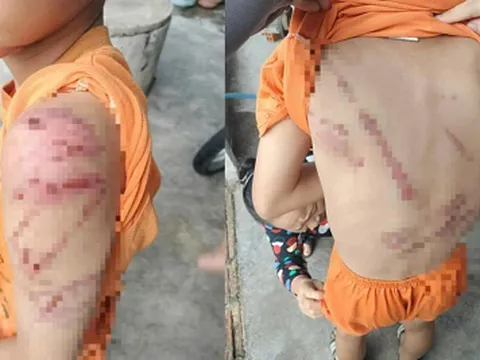 Bố “dạy con” bằng bạo lực, cơ quan công an vào cuộc