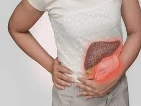 Một cơn đau bụng nửa đêm sau ăn buffet, cô gái trẻ rơi vào sốc và tử vong trong 48 giờ