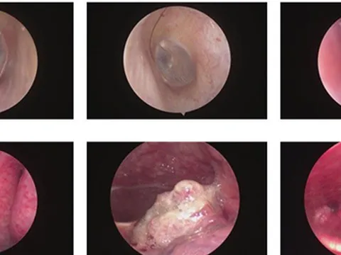 Sụt 5kg trong 1 tháng, người đàn ông 47 tuổi mắc cùng lúc 2 bệnh ung thư: Thủ phạm từ thói quen uống 300ml loại đồ uống này mỗi ngày