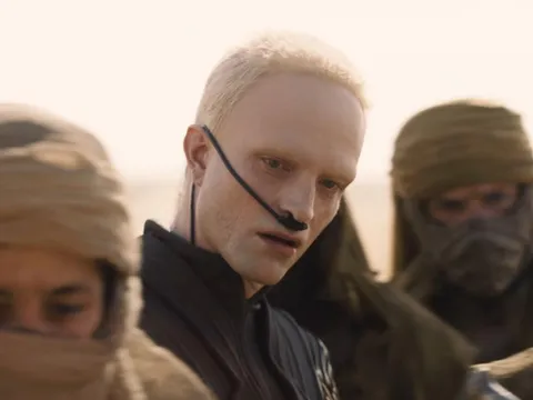 Robert Pattinson gây sốc với tạo hình "hủy dung nhan": Phép thử liều lĩnh lấn át cả dàn sao Dune 3