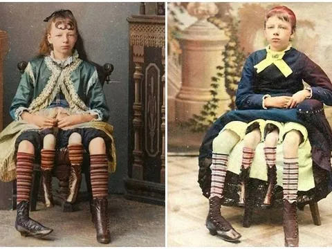 Cô gái bốn chân, sở hữu hai tử cung, sinh hạ 7 người con khiến y học kinh ngạc