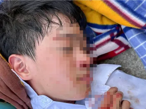 Nam sinh lớp 6 bị đánh chảy máu đầu phải nhập viện ở Nha Trang: Bất ngờ lý do gia đình không yêu cầu xử lý