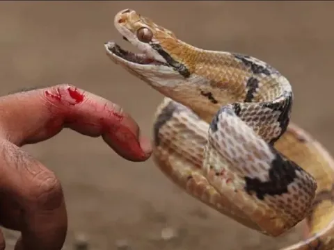 Giây phút sinh tử của người đàn ông bị rắn hổ mang cắn: Độc tính phát tác gây liệt tay, khó thở