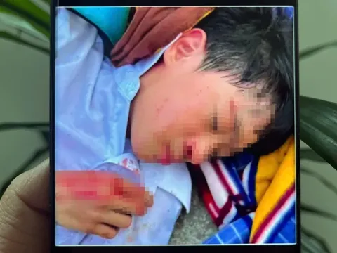 Vụ nam sinh lớp 6 bị bạn học đánh hội đồng: Thông tin chính thức từ công an, hé lộ nguyên nhân đau lòng