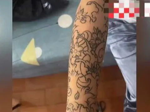 Con gái dậy thì thường xuyên mặc áo dài tay dù rất nóng, người mẹ suy sụp khi phát hiện hình vẽ khủng khiếp dưới tay áo