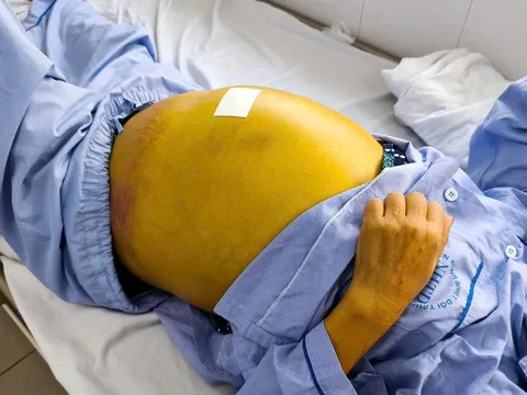 Da vàng như nghệ, đau chân, đi khám bất ngờ phát hiện... viêm gan B giai đoạn cuối