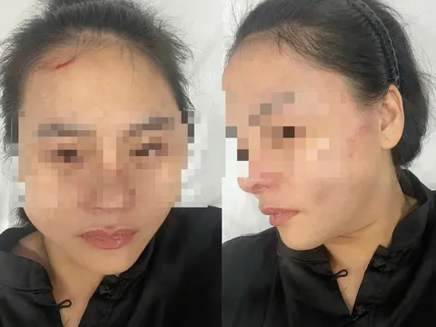 Nữ chủ quán bún riêu hoảng loạn kể lại khoảnh khắc bị chủ nhà khóa cửa, lao vào hành hung